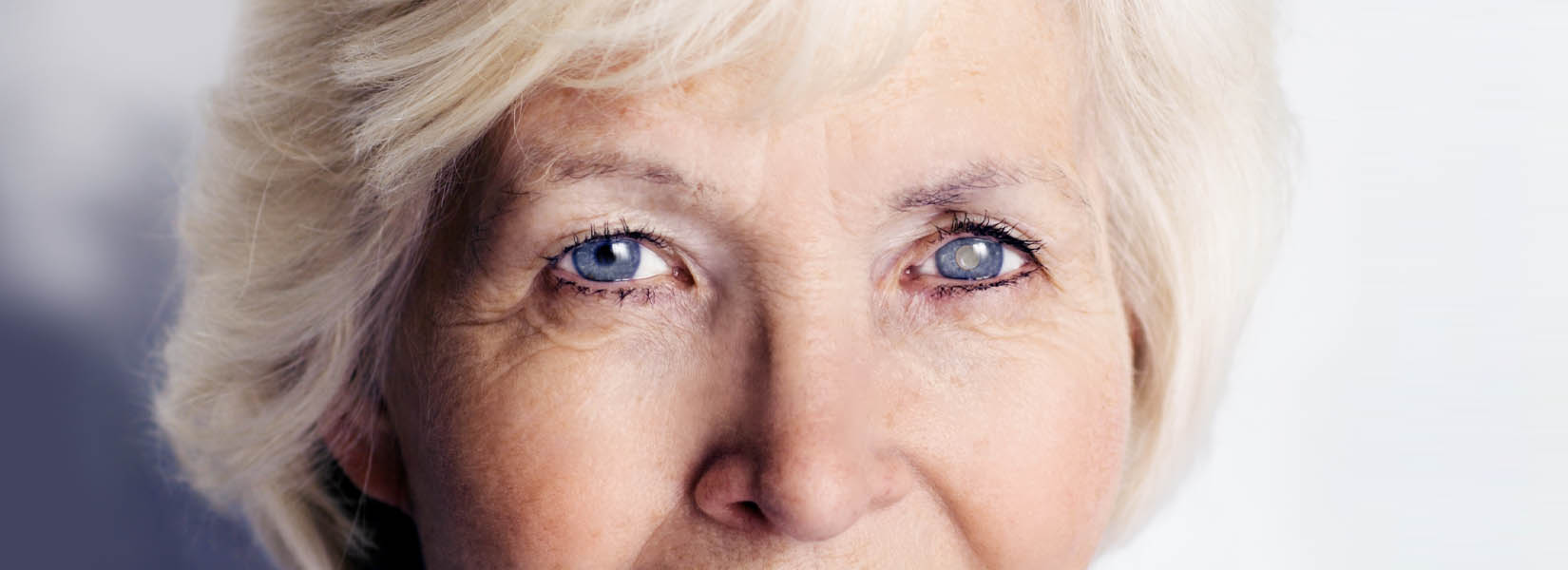 Cataract Surgery in Centennial